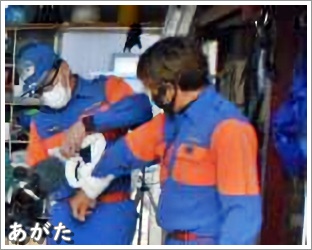 固定法(腕の骨折)