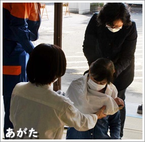 固定法(腕の骨折)